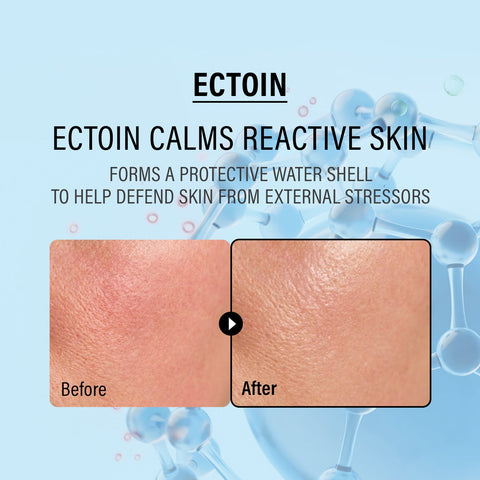 epii Double Up Cream Ectoin - ingredients