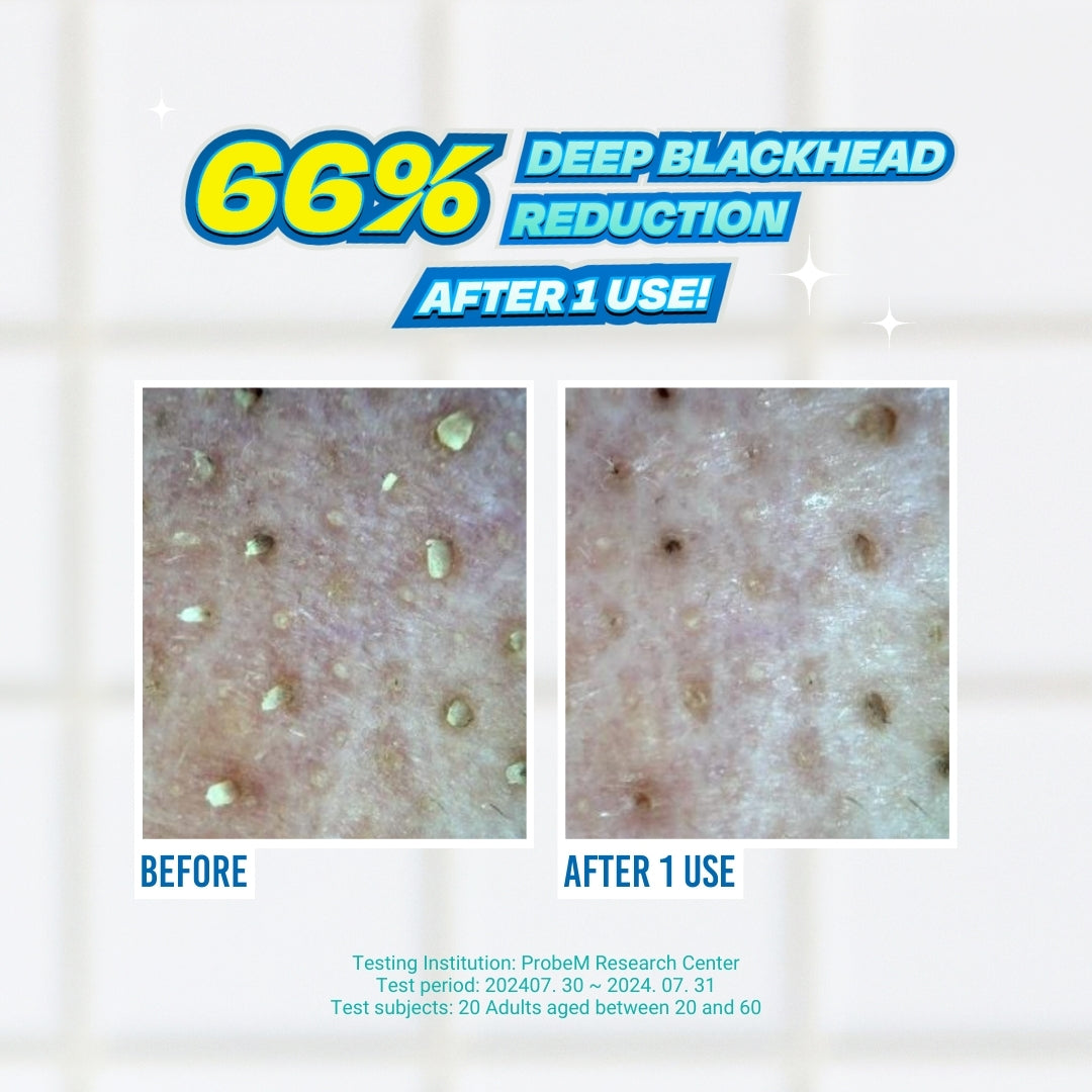 JUMISO Blackhead Melting Softener - how to use
