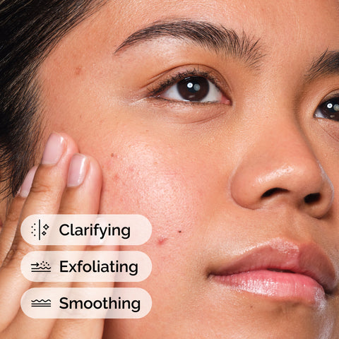 The Ordinary Salicylic Acid 2% Solution application
