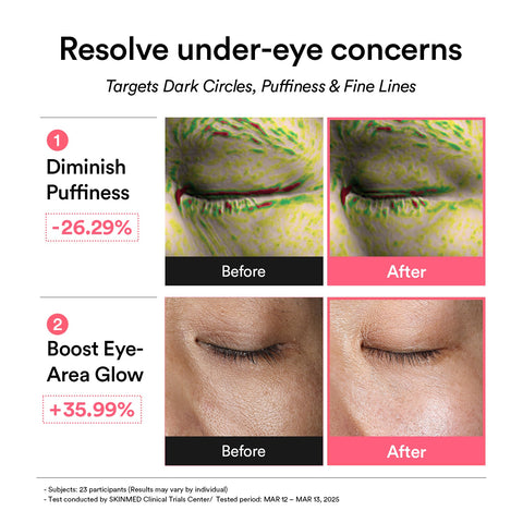 Abib PDRN Retinal Eye Patch - before after