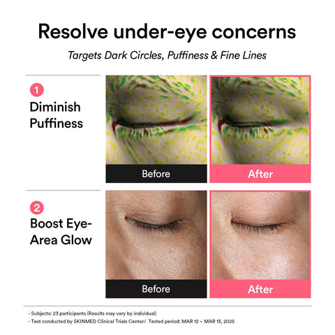 Abib PDRN Retinal eye patch for dark circles