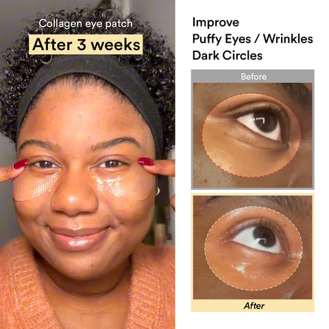 Abib Jericho Rose eye patch clinical results