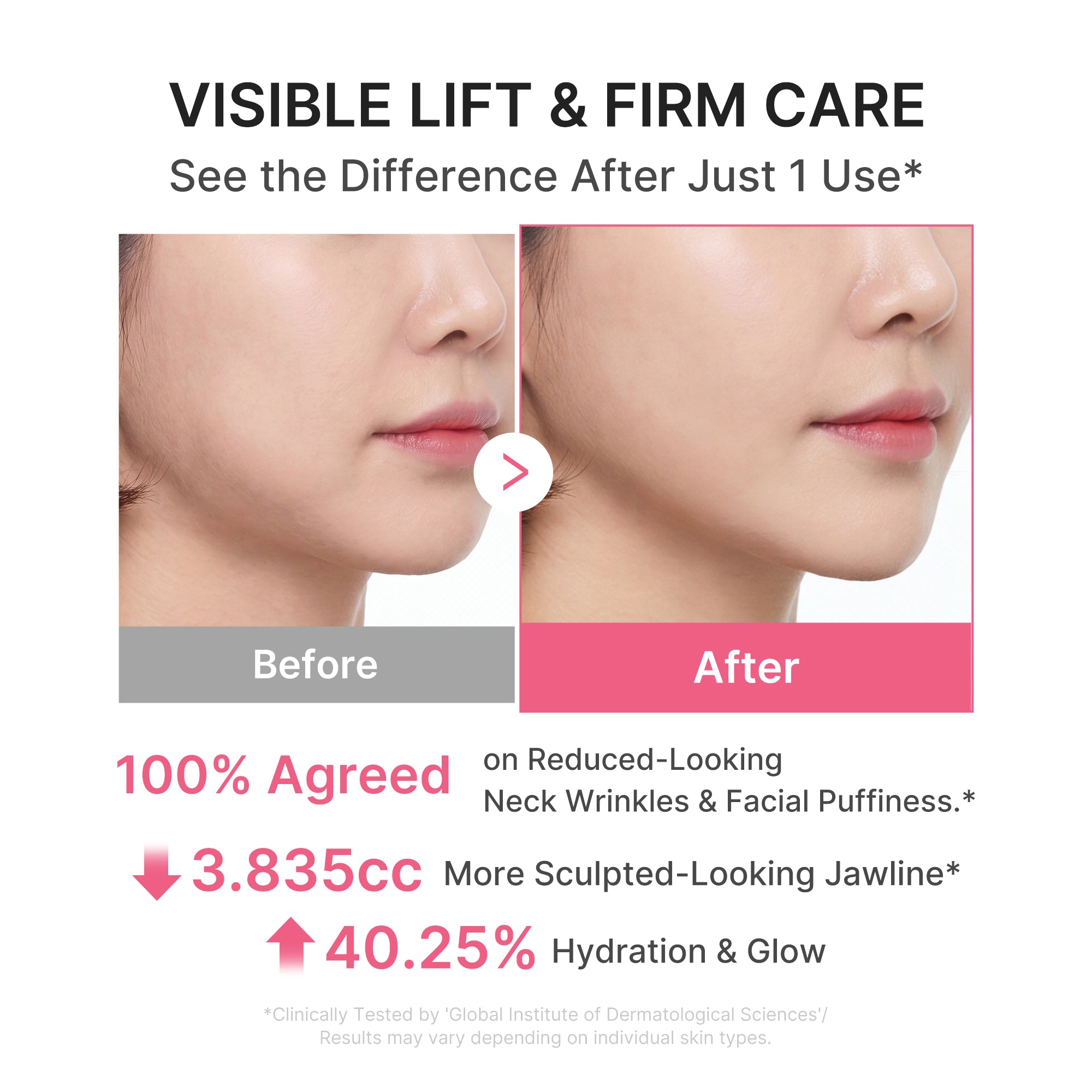 Medicube neck wrinkle cream results - firmer neck and jawline