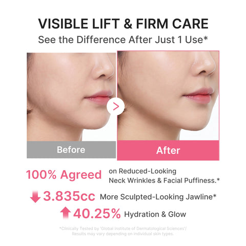 Medicube neck wrinkle cream results - firmer neck and jawline