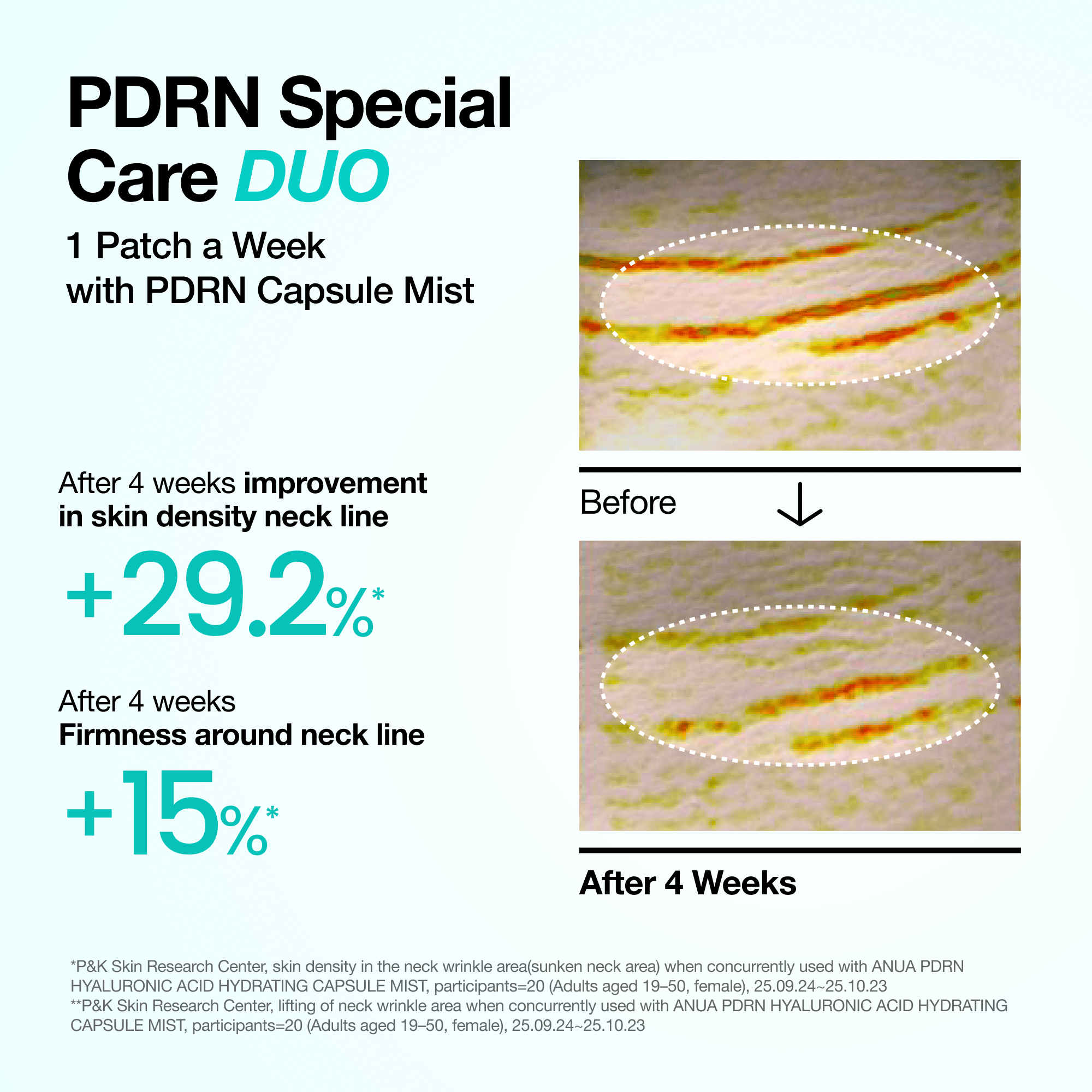 ANUA PDRN Collagen Melting Patch for Neck 4 Patches
