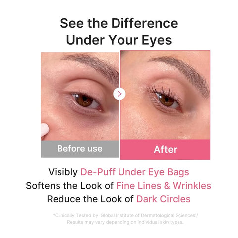 Before and after under-eye results with Medicube PDRN Jelly Eye Mask